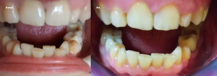 Referencia: Extrakcia zuba – Ako sa jej vyhnúť pomocou dentozofie?